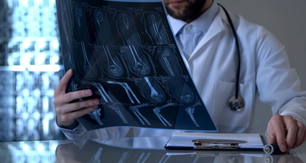 Orthopaedic Oncology